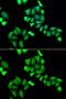 UDP-Galactose-4-Epimerase antibody, GTX33212, GeneTex, Immunofluorescence image 