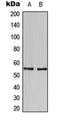HMG-Box Transcription Factor 1 antibody, orb224090, Biorbyt, Western Blot image 