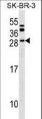 BAF Chromatin Remodeling Complex Subunit BCL7C antibody, LS-C159173, Lifespan Biosciences, Western Blot image 