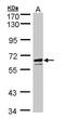 Glucose-6-phosphate 1-dehydrogenase antibody, GTX101218, GeneTex, Western Blot image 