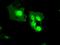 MX Dynamin Like GTPase 1 antibody, MA5-24914, Invitrogen Antibodies, Immunocytochemistry image 