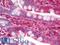Mel antibody, LS-B10994, Lifespan Biosciences, Immunohistochemistry paraffin image 