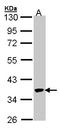 PCIF1 antibody, LS-C109401, Lifespan Biosciences, Western Blot image 
