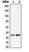 Plasma serine protease inhibitor antibody, orb215386, Biorbyt, Western Blot image 