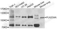 Cytosolic phospholipase A2 antibody, A0394, ABclonal Technology, Western Blot image 