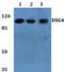 Desmoglein 4 antibody, PA5-37155, Invitrogen Antibodies, Western Blot image 