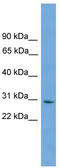 Protein canopy homolog 3 antibody, TA344531, Origene, Western Blot image 