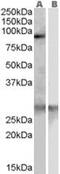 Scavenger Receptor Class F Member 1 antibody, MBS420351, MyBioSource, Western Blot image 