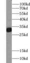 Calbindin 1 antibody, FNab01193, FineTest, Western Blot image 