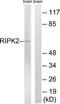 Receptor-interacting serine/threonine-protein kinase 2 antibody, TA312994, Origene, Western Blot image 
