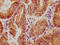 Yes Associated Protein 1 antibody, CSB-RA026244A127phHU, Cusabio, Immunohistochemistry frozen image 