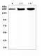 ATP Binding Cassette Subfamily C Member 8 antibody, A00895-1, Boster Biological Technology, Western Blot image 