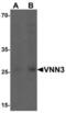 Vanin 3 antibody, NBP2-81875, Novus Biologicals, Western Blot image 