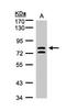 L3MBTL Histone Methyl-Lysine Binding Protein 1 antibody, LS-C185565, Lifespan Biosciences, Western Blot image 