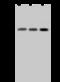 Succinate-CoA Ligase ADP-Forming Beta Subunit antibody, GTX02367, GeneTex, Western Blot image 