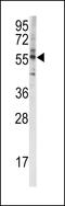CYP4F8 antibody, 63-270, ProSci, Western Blot image 