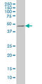 E2F Transcription Factor 3 antibody, LS-C197095, Lifespan Biosciences, Western Blot image 