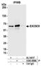 EXOSC9 antibody, A303-888A, Bethyl Labs, Immunoprecipitation image 