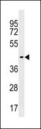 Zinc Finger Protein 662 antibody, 60-387, ProSci, Western Blot image 