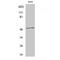B1AR antibody, LS-C382153, Lifespan Biosciences, Western Blot image 