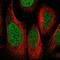 Zinc Finger Protein 512 antibody, NBP1-81371, Novus Biologicals, Immunocytochemistry image 
