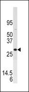 Dual Specificity Phosphatase 3 antibody, MBS9214775, MyBioSource, Western Blot image 