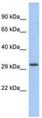 Fibroblast Growth Factor 13 antibody, TA333983, Origene, Western Blot image 