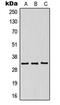 Killer Cell Immunoglobulin Like Receptor, Two Ig Domains And Short Cytoplasmic Tail 5 antibody, MBS821722, MyBioSource, Western Blot image 