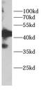 Pim-1 Proto-Oncogene, Serine/Threonine Kinase antibody, FNab10087, FineTest, Western Blot image 