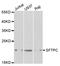 Pulmonary surfactant-associated protein C antibody, TA332441, Origene, Western Blot image 
