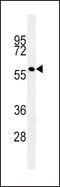 GP6 antibody, LS-B13747, Lifespan Biosciences, Western Blot image 