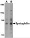 Syntaphilin antibody, 4617, ProSci Inc, Western Blot image 