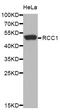 Regulator Of Chromosome Condensation 1 antibody, orb373369, Biorbyt, Western Blot image 