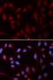 NPC Intracellular Cholesterol Transporter 2 antibody, orb167327, Biorbyt, Immunocytochemistry image 