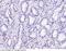 Tumor Protein P63 antibody, 100266-R143, Sino Biological, Immunohistochemistry frozen image 