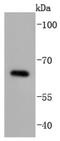 Cell Division Cycle 25B antibody, NBP2-67893, Novus Biologicals, Western Blot image 