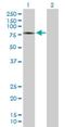 Zinc Finger SWIM-Type Containing 2 antibody, H00151112-B01P, Novus Biologicals, Western Blot image 