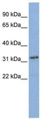 Small Nuclear RNA Activating Complex Polypeptide 2 antibody, TA329240, Origene, Western Blot image 
