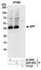 Histocompatibility Minor 13 antibody, A304-404A, Bethyl Labs, Immunoprecipitation image 