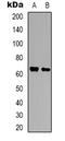 Brain Enriched Guanylate Kinase Associated antibody, LS-C368840, Lifespan Biosciences, Western Blot image 