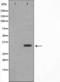 Protein Phosphatase 1 Regulatory Inhibitor Subunit 1B antibody, TA326030, Origene, Western Blot image 