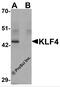 Kruppel Like Factor 4 antibody, PM-6142, ProSci, Western Blot image 
