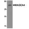 Melanoma-associated antigen 4 antibody, TA349177, Origene, Western Blot image 