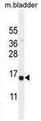 Cysteine Rich Hydrophobic Domain 2 antibody, AP50896PU-N, Origene, Western Blot image 