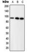 Progesterone Receptor antibody, orb214389, Biorbyt, Western Blot image 