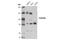 Palladin, Cytoskeletal Associated Protein antibody, 8518S, Cell Signaling Technology, Western Blot image 