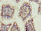 Oxidative Stress Responsive Serine Rich 1 antibody, CSB-PA865164LA01HU, Cusabio, Immunohistochemistry paraffin image 