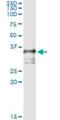 Translocase Of Outer Mitochondrial Membrane 34 antibody, H00010953-M02, Novus Biologicals, Immunoprecipitation image 