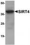 NAD-dependent ADP-ribosyltransferase sirtuin-4 antibody, TA319856, Origene, Western Blot image 