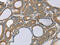 Sorting Nexin Family Member 30 antibody, CSB-PA239255, Cusabio, Immunohistochemistry paraffin image 